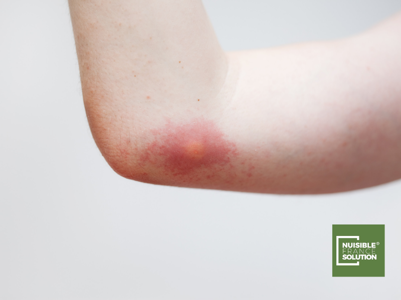 Montauban guepe Nuisible France Solution société