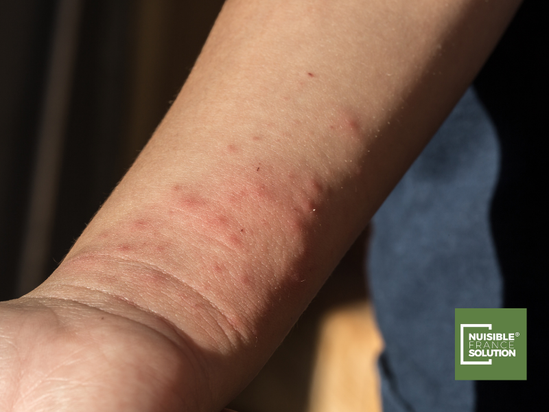 Punaise de Lit à Toulouse : Achat de Produits ou intervention d'un Professionnel ?